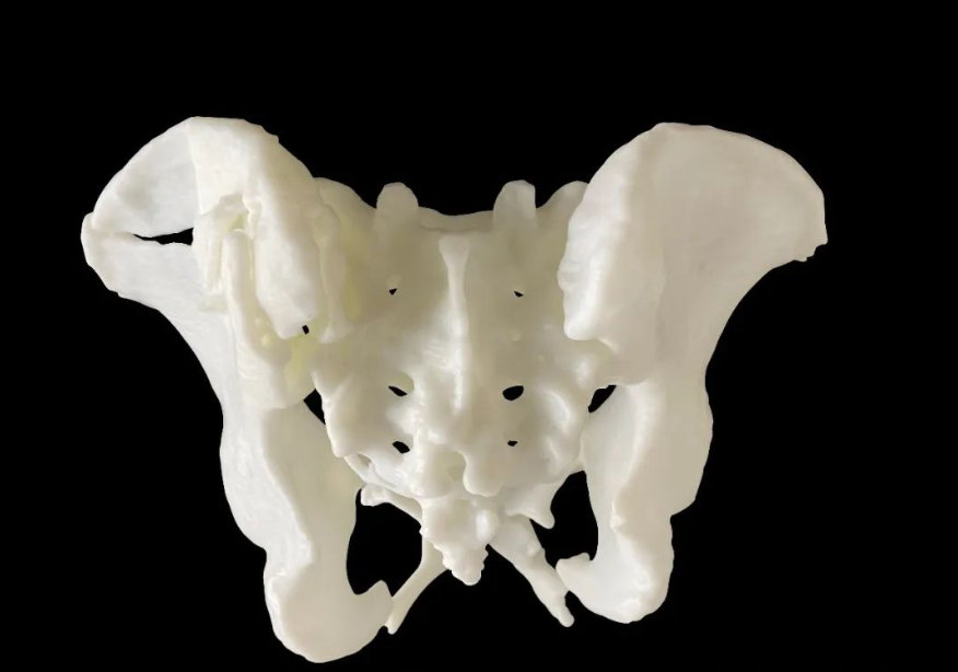 科學(xué)家3D打印出珊瑚仿生骨移植替代品，僅需2-4周即可長出新骨 image