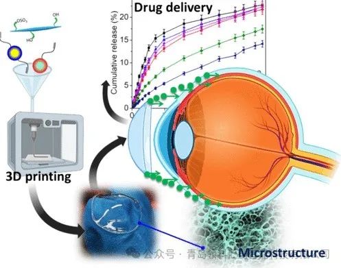 3D打印水凝膠隱形眼鏡，可在眼部持續(xù)釋放藥物 圖片